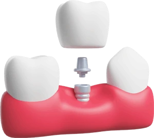tooth